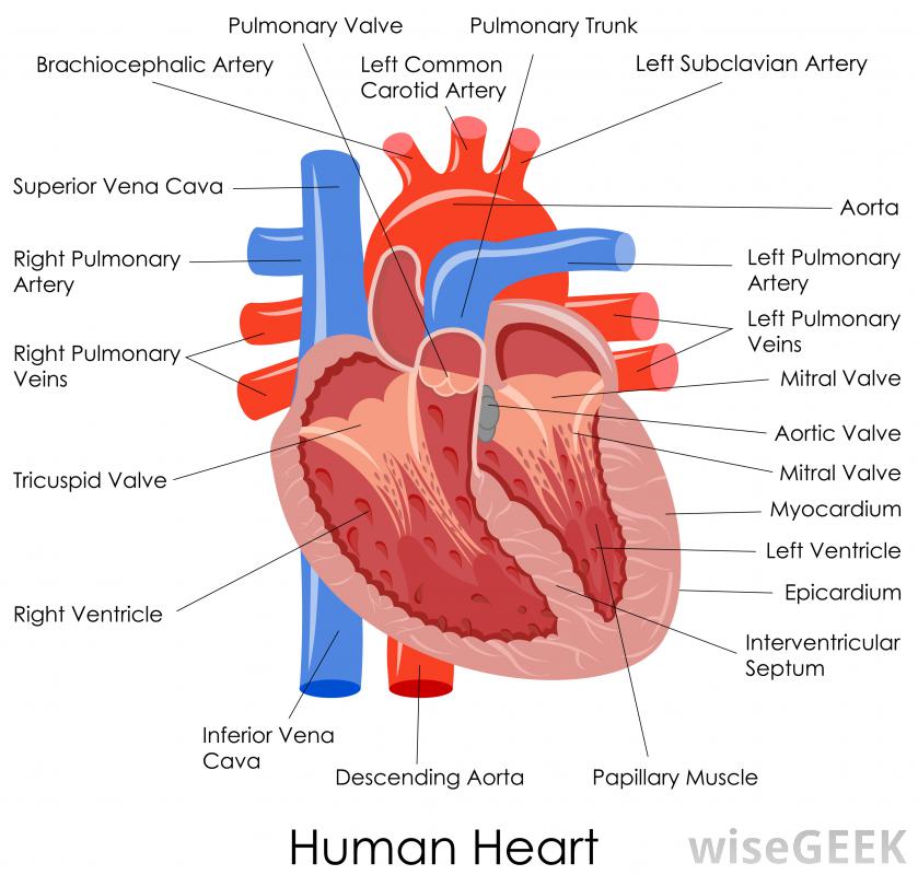 What is a stent graft?